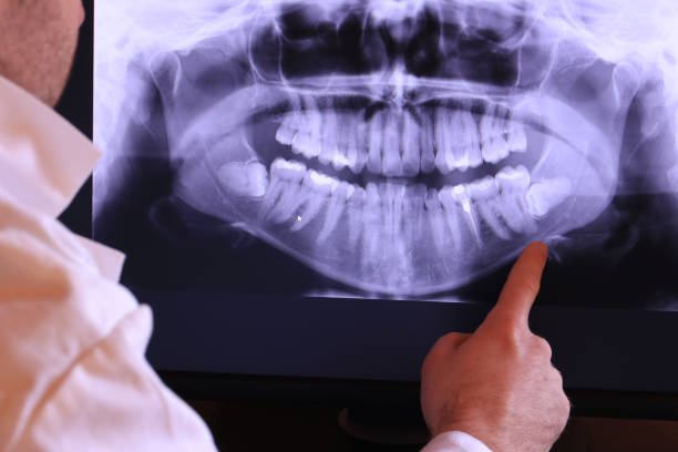 Best Emergency Root Canal Treatment in Martinsville, VA